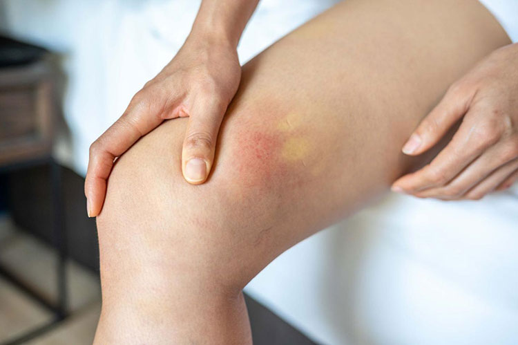 Effective against swelling