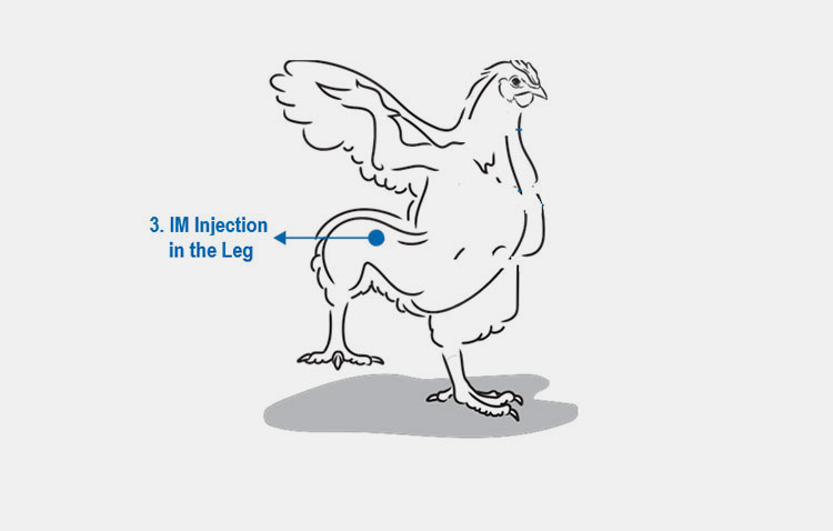 Intramuscular injection