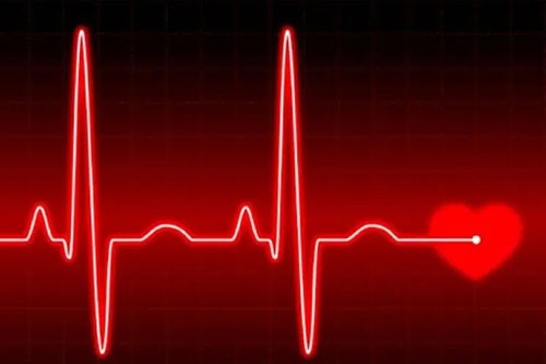 Irregular Heartbeat