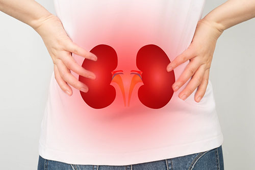 Kidney Issues