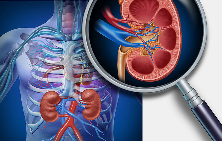 Patients with severe kidney disease