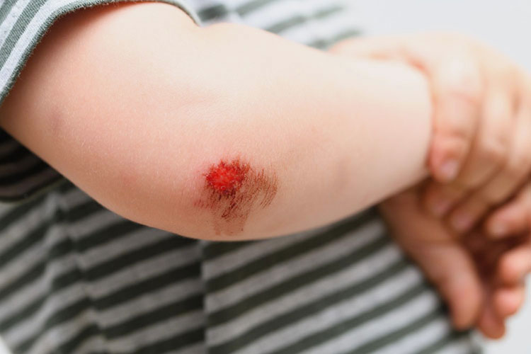 Skin infection