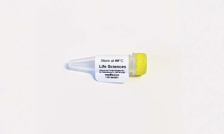 T7 RNA Polymerase
