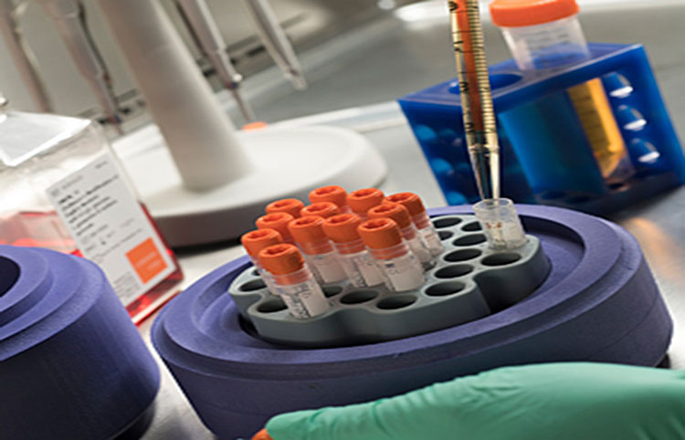 Tips To Handle Recovery Cell Culture Freezing Medium