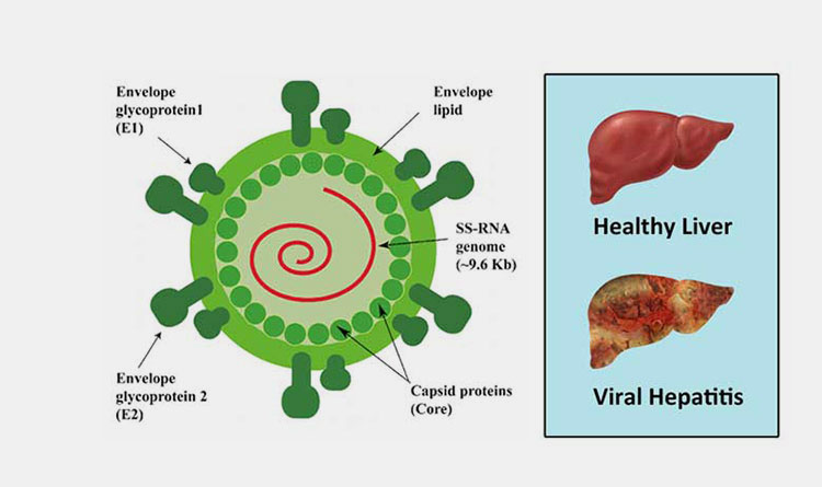 interferon therapy for hepatitis c works-1