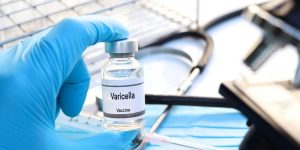 Varicella Vaccine Production