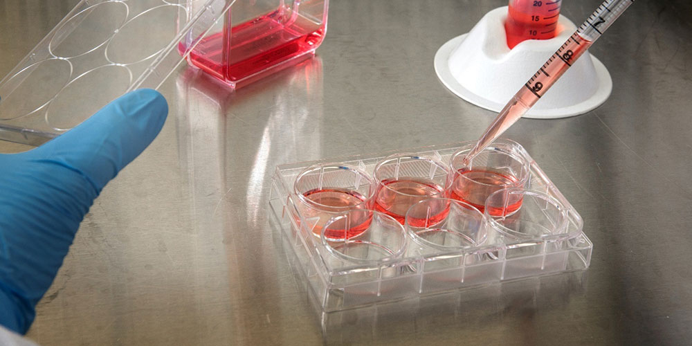Dmem Cell Culture Medium
