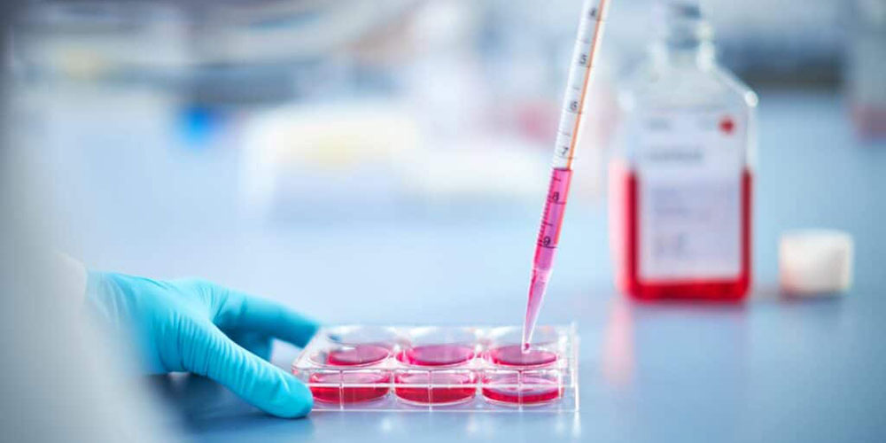 Recovery Cell Culture Freezing Medium
